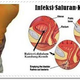 Illustration for article titled Resep Dokter obat infeksi saluran kemih paling ampuh dan manjurem/em